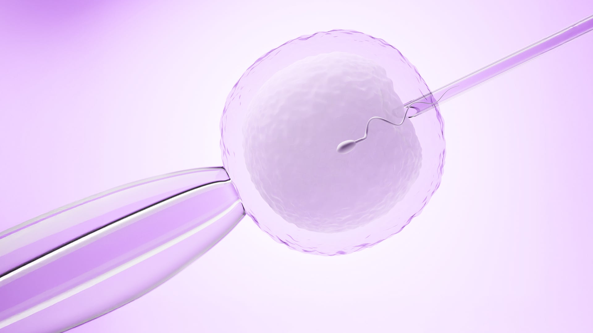 Advanced Infertility & IVF